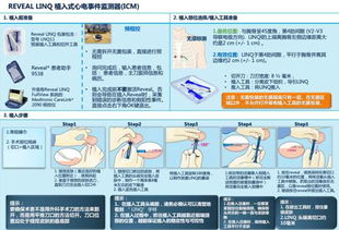 北京市卫生科技成果与适宜技术推广项目植入式心电事件监测器的临床应用推广